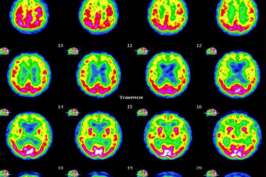 Anomalous Experiences, Psi and Functional Neuroimaging