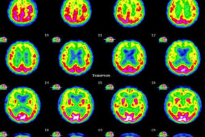 Anomalous Experiences, Psi and Functional Neuroimaging